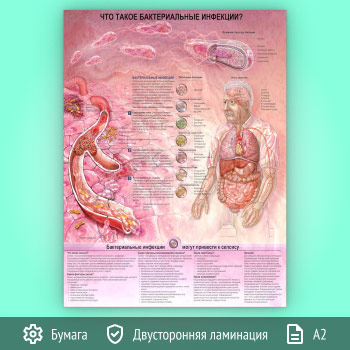 Плакат «Что такое бактериальные инфекции?» (ЗОЖ-39, 1 лист, А2)